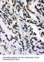 Anti-SNRPN Antibody
