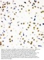 Anti-SNRPN Antibody