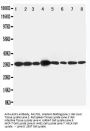Anti-LIM and SH3 domain protein 1 LASP1 Antibody Picoband®