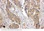 Anti-LIM and SH3 domain protein 1 LASP1 Antibody Picoband®