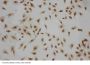 Anti-LIM and SH3 domain protein 1 LASP1 Antibody Picoband®