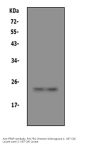 Anti-Prion protein PrP/PRNP Antibody Picoband®