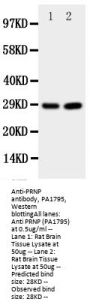 Anti-Prion protein PrP/PRNP Antibody Picoband®