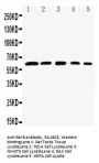 Anti-Rel B/RELB Antibody Picoband®