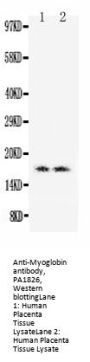 Anti-Myoglobin/MB Antibody Picoband®
