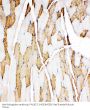 Anti-Myoglobin/MB Antibody Picoband®