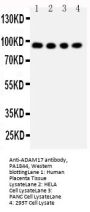 Anti-ADAM17 Antibody Picoband®