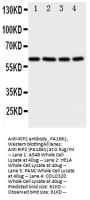 Anti-RIP2/RIPK2 Antibody Picoband®