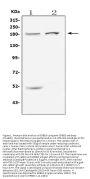 Anti-ErbB 3/ERBB3 Antibody Picoband®