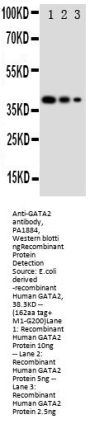 Anti-GATA2 Antibody Picoband®