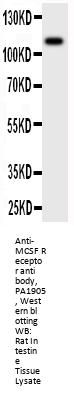 Anti-MCSF Receptor/CSF1R Antibody Picoband®