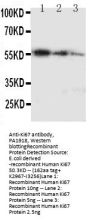 Anti-Ki67/MKI67 Antibody Picoband®