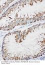 Anti-MEKK1/MAP3K1 Antibody Picoband®