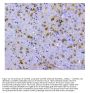 Anti-SQSTM1/p62 Antibody Picoband®