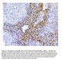 Anti-SQSTM1/p62 Antibody Picoband®