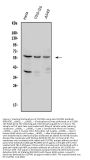 Anti-SQSTM1/p62 Antibody Picoband®