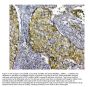 Anti-SQSTM1/p62 Antibody Picoband®