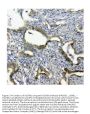 Anti-SQSTM1/p62 Antibody Picoband®