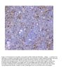 Anti-SQSTM1/p62 Antibody Picoband®