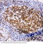 Anti-RIAM/APBB1IP Antibody Picoband®