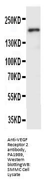 Anti-VEGF Receptor 2/KDR Antibody Picoband®
