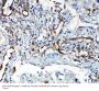 Anti-VEGF Receptor 2/KDR Antibody Picoband®