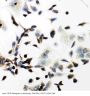 Anti-VEGF Receptor 2/KDR Antibody Picoband®