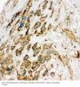 Anti-VEGF Receptor 2/KDR Antibody Picoband®