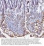 Anti-Bid Antibody Picoband®