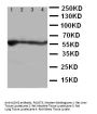 Anti-ALDH2 Antibody Picoband®