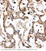 Anti-ALDH2 Antibody Picoband®