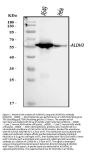 Anti-ALDH3A1 Antibody Picoband®
