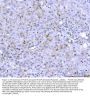 Anti-PCSK9 Antibody Picoband®