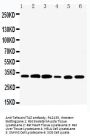 Anti-Tafazzin/TAZ Antibody Picoband®