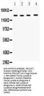 Anti-Matrix metalloproteinase-14 MMP14 Antibody Picoband®