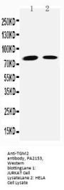 Anti-Transglutaminase 2/TGM2 Antibody Picoband®