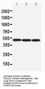 Anti-beta Arrestin 1/ARRB1 Antibody Picoband®