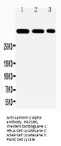 Anti-Laminin 2 alpha/LAMA2 Antibody Picoband®