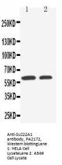 Anti-SLC22A1 Antibody Picoband®