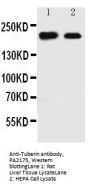Anti-Tuberin/TSC2 Antibody Picoband®