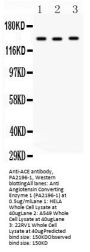 Anti-Angiotensin Converting Enzyme 1/ACE Antibody Picoband®