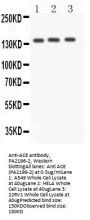 Anti-Angiotensin Converting Enzyme 1/ACE Antibody Picoband®