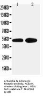 Anti-alpha 2a Adrenergic Receptor/ADRA2A Antibody Picoband®