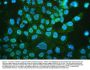 Anti-muscarinic Acetylcholine Receptor 1/CHRM1 Antibody