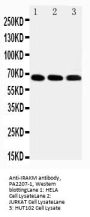 Anti-IRAKM/IRAK3 Antibody Picoband®