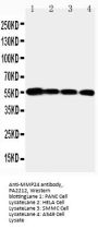 Anti-Matrix metalloproteinase-24 MMP24 Antibody Picoband®