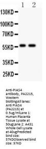 Anti-E3 SUMO-protein ligase PIAS4 Antibody Picoband®