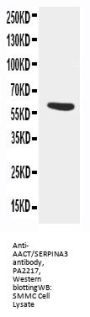 Anti-AACT/SERPINA3 Antibody Picoband®