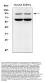 Anti-Sodium/hydrogen exchanger 2 SLC9A2 Antibody Picoband®