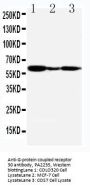 Anti-G-protein coupled receptor 30/GPER1 Antibody Picoband®